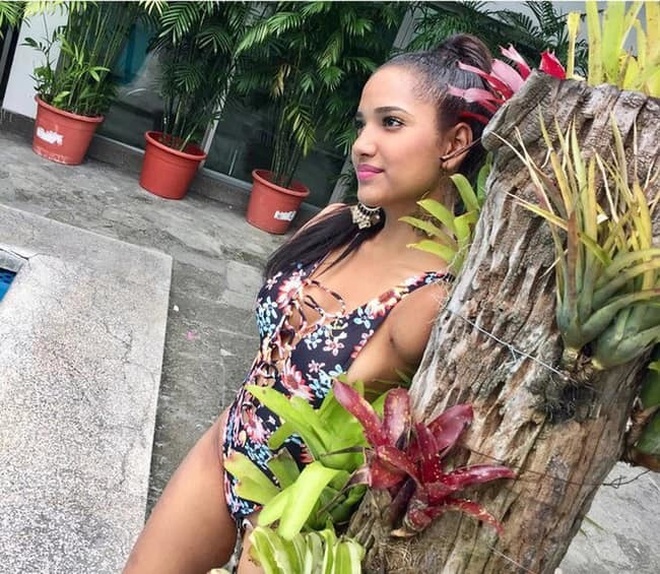 Mỹ nhân bị cưa hai tay vào chung kết Hoa hậu Ecuador 2021 - 8