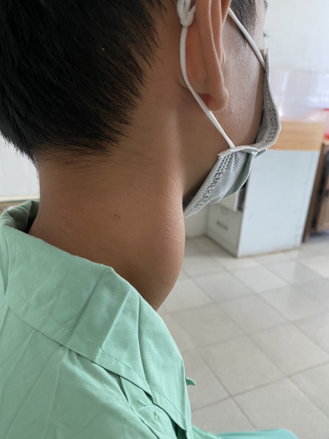 Quảng Nam: Phẫu thuật khối u lớn hiếm gặp ở vùng cổ bệnh nhân 13 tuổi - 1 Quảng Nam: Phẫu thuật khối u lớn hiếm gặp ở vùng cổ bệnh nhân 13 tuổi - 1