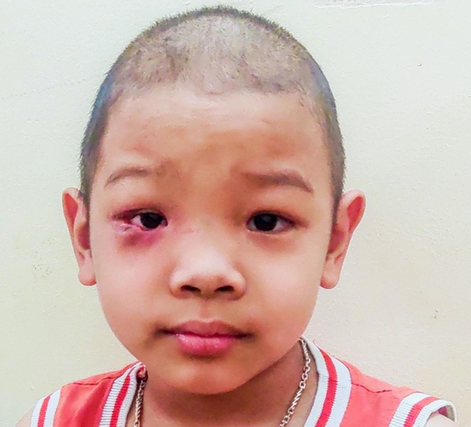 Cậu bé 7 tuổi tái ung thư: Mẹ vào thuốc... con mới sống được - 6 Cậu bé 7 tuổi tái ung thư: Mẹ vào thuốc... con mới sống được - 6