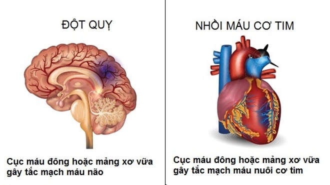 Mỡ máu: Sát thủ thầm lặng ngày càng trẻ hóa - 2