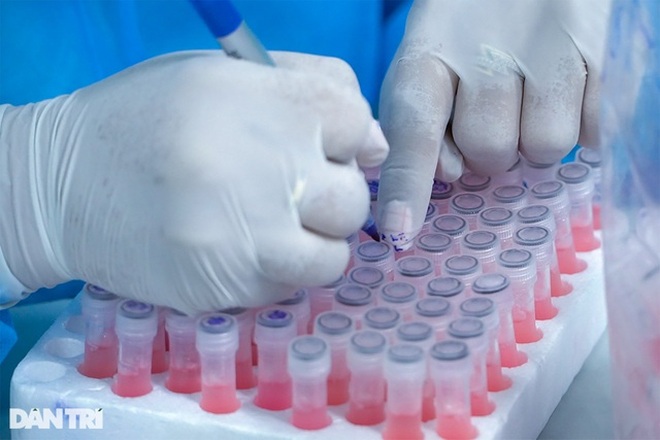 Bộ Y tế yêu cầu báo cáo khẩn giá bán test xét nghiệm SARS-CoV-2 - 1