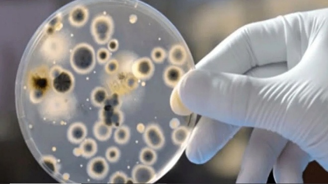 Mỹ phát hiện ca bệnh nấm nguy hiểm chết người có thể kháng mọi loại thuốc - 1