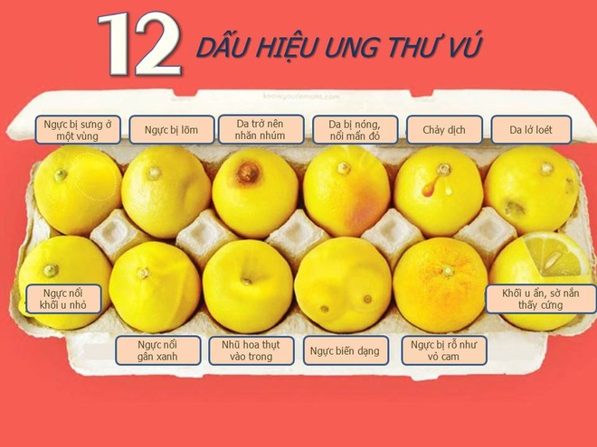 Phát hiện ung thư vú nhờ vào bức hình về 12 quả chanh - 2