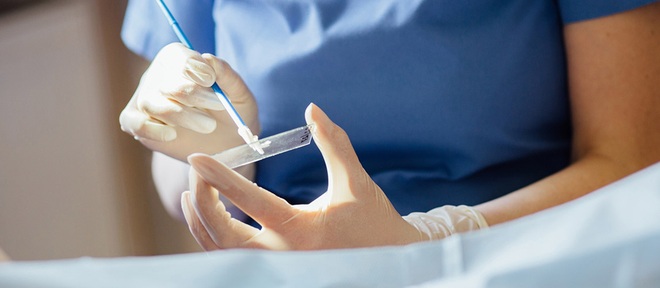 Phát hiện tế bào bất thường sau xét nghiệm Pap có phải ung thư? - 1 Phát hiện tế bào bất thường sau xét nghiệm Pap có phải ung thư? - 1