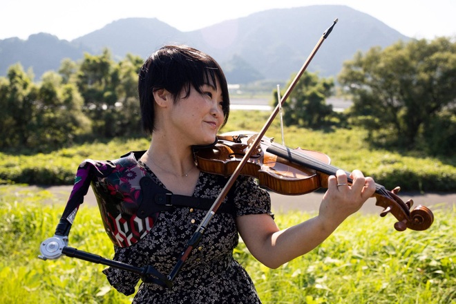 Người phụ nữ mất một cánh tay trở thành y tá, vận động viên, nghệ sĩ violin - 1 Người phụ nữ mất một cánh tay trở thành y tá, vận động viên, nghệ sĩ violin - 1