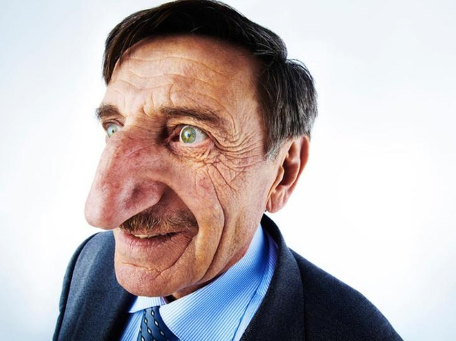 Người đàn ông có chiếc mũi dài nhất thế giới - 1