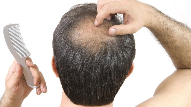 Da đầu khỏe, tóc mọc nhanh nhờ liệu pháp chăm sóc da đầu tại Petunia Charm Center - 1
