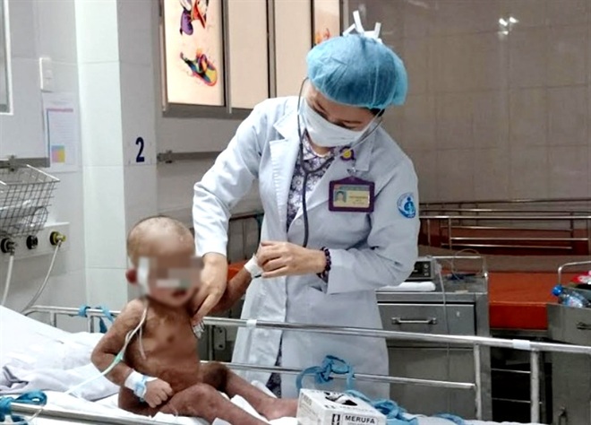 TPHCM: Cha mẹ xông hơi trị Covid-19 cho con, nhiều trẻ bỏng nặng thương tâm - 2