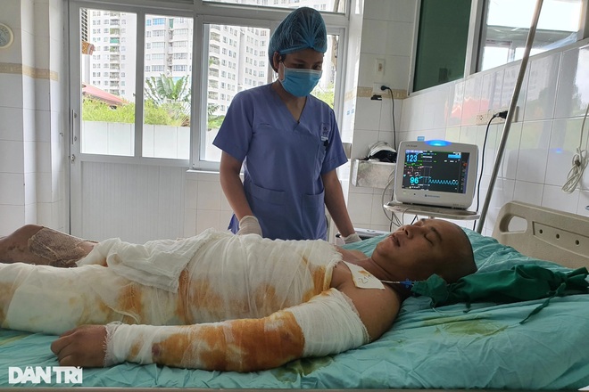 Thương người đàn ông cháy như bó đuốc sau cú phóng điện cao thế oan nghiệt - 1 Thương người đàn ông cháy như bó đuốc sau cú phóng điện cao thế oan nghiệt - 1
