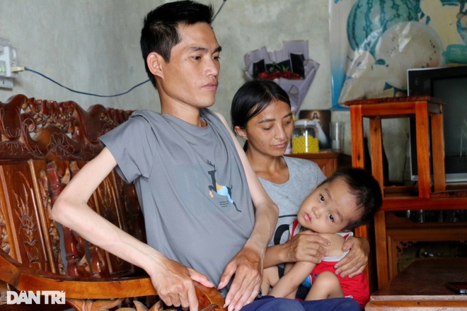 Bố tật nguyền, mẹ thiểu năng, thương bé trai 4 tuổi mắc bệnh hiểm nghèo - 3