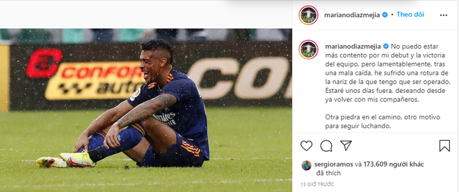 Kinh hoàng khoảnh khắc ngôi sao Real Madrid ngã cắm mặt, máu chảy đầm đìa - 2 Kinh hoàng khoảnh khắc ngôi sao Real Madrid ngã cắm mặt, máu chảy đầm đìa - 2
