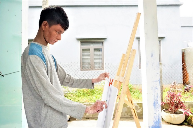 Cuộc sống của cậu bé người rắn từng bị xa lánh bây giờ ra sao? - 11