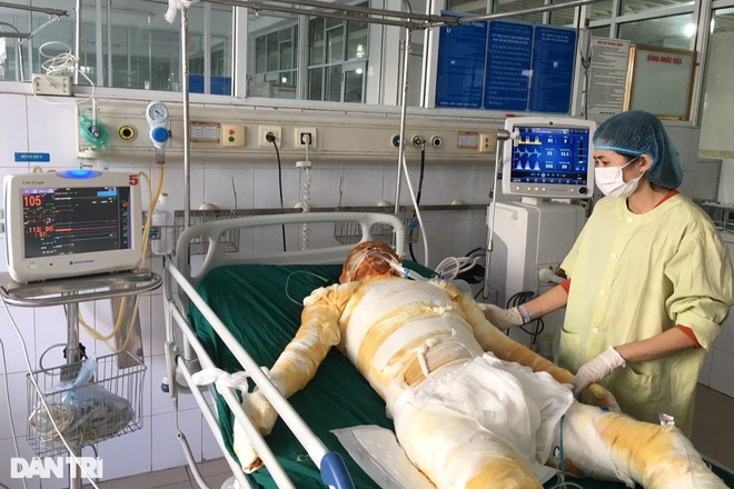 Người cha lao vào biển lửa cứu con đã đầu hàng số phận - 2 Người cha lao vào biển lửa cứu con đã đầu hàng số phận - 2
