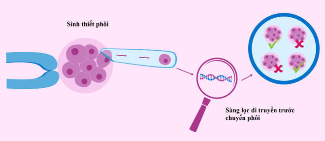 Triển khai kỹ thuật PGT-M trong sàng lọc phôi tiền làm tổ các bệnh hiếm - 1