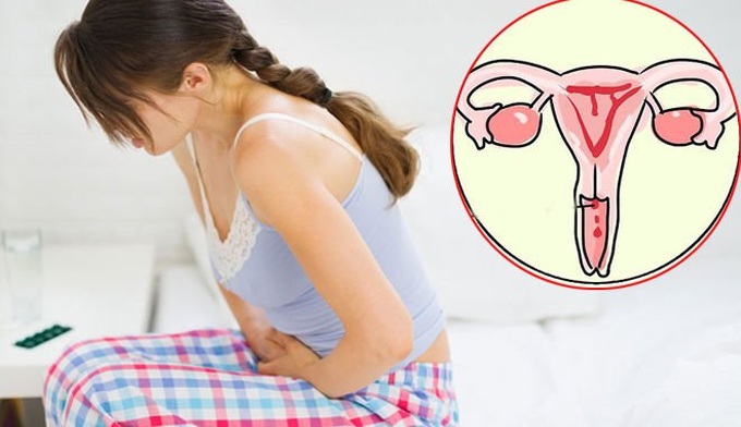 Dấu hiệu nhận diện 2 loại ung thư có thể khiến chị em mất cơ hội làm mẹ