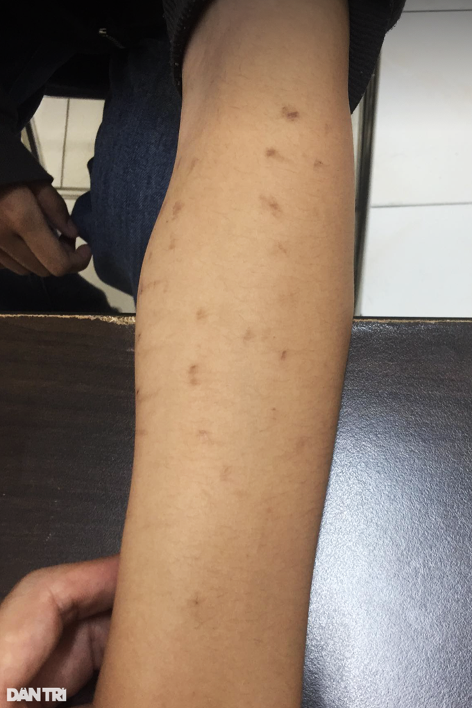 Cô gái trầm cảm nặng, muốn chết cho xong vì... sợ bệnh tiểu đường - 1 Cô gái trầm cảm nặng, muốn chết cho xong vì... sợ bệnh tiểu đường - 1