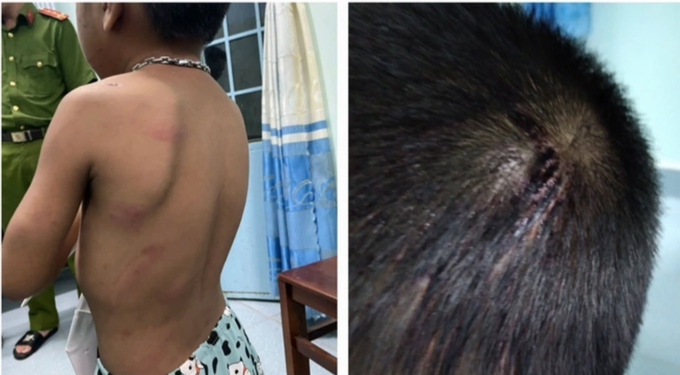 Dì ghẻ đối mặt án tử hình và những đứa trẻ bị đánh đập kinh hoàng