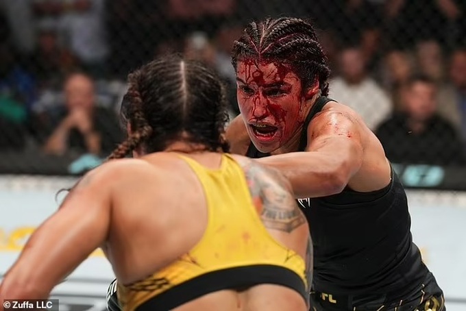 Gương mặt đẫm máu của nữ võ sĩ sau trận đấu tàn khốc - 2