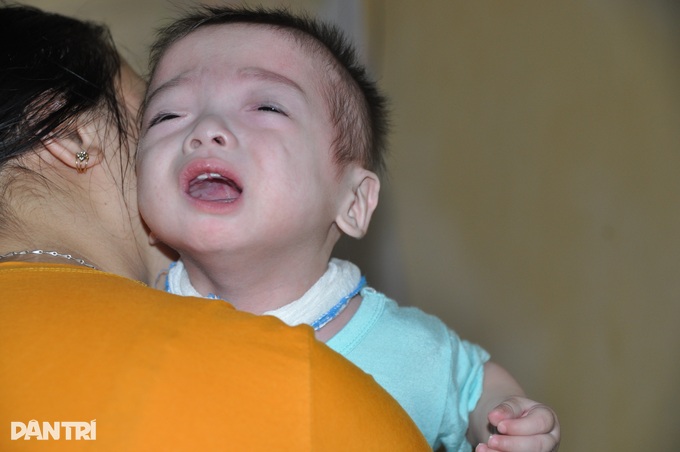 Cùng cực mẹ nghèo suy giáp ôm con bại não khóc ròng trong phòng trọ - 1 Cùng cực mẹ nghèo suy giáp ôm con bại não khóc ròng trong phòng trọ - 1