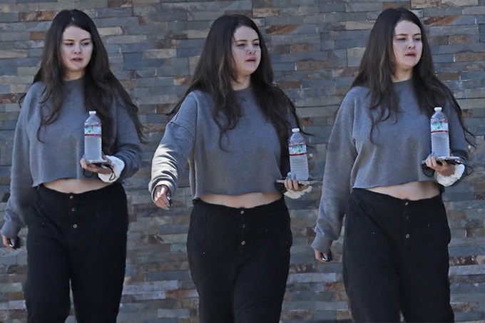 Selena Gomez: Xinh đẹp nhưng khổ sở cả tinh thần, thể xác vì bệnh tật