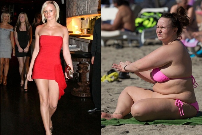 Người mẫu Chanelle Hayes giảm 57 kg nhờ phẫu thuật