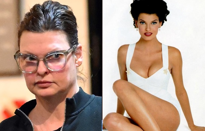 Linda Evangelista tái xuất quyến rũ sau ca phẫu thuật thẩm mỹ hỏng