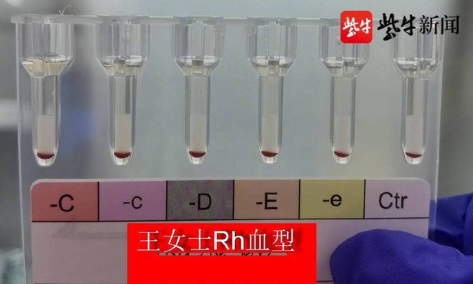Có những thông tin nào khác về nhóm máu hiếm nhất Rh-null cần biết?
