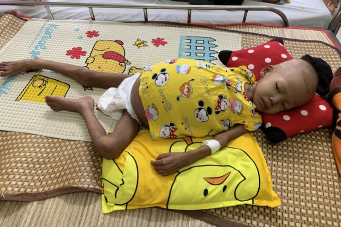 Người mẹ chạy vạy mượn tiền để cứu con gái gầy trơ xương - 1 Người mẹ chạy vạy mượn tiền để cứu con gái gầy trơ xương - 1