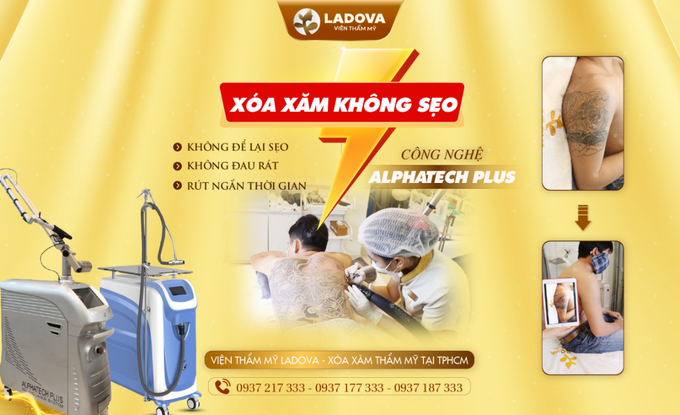 Xoá hình xăm có đau để lại sẹo không Tẩy giá bao nhiêu