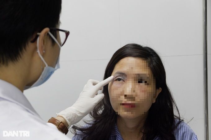 Hà Nội: Kiến ba khoang vào mùa, nhiều người nhập viện vì sưng mắt, loét da