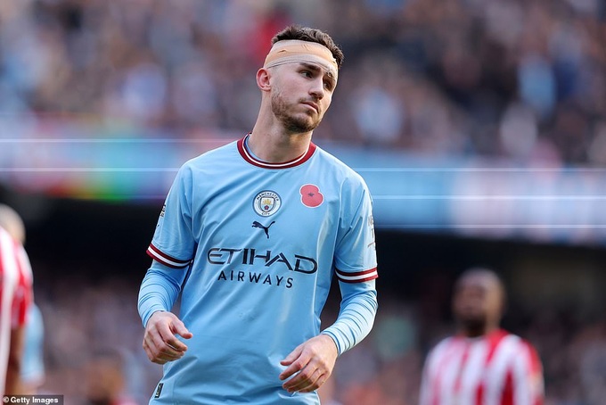 Haaland vô duyên, Man City thua đau đớn Brentford - 3 Haaland vô duyên, Man City thua đau đớn Brentford - 3