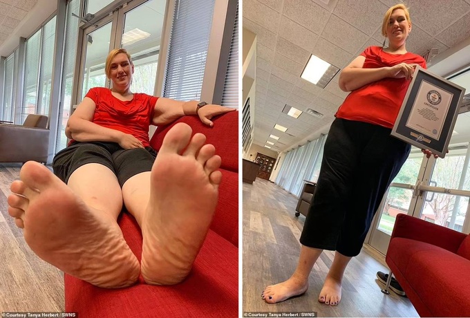 Nỗi khổ của người phụ nữ lập Kỷ lục Guinness Thế giới với bàn chân khủng - 1