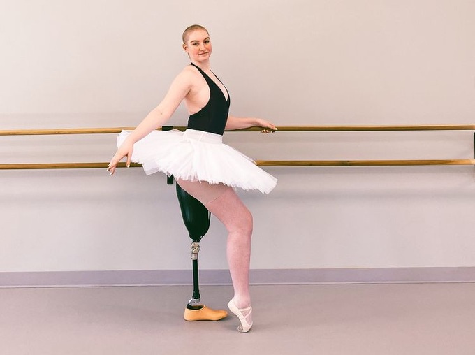 The extraordinary energy of a 21-year-old dancer with cancer, had one leg amputated - 2