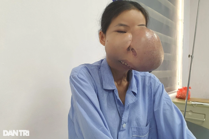 Người mẹ mang gương mặt kỳ dị hy sinh sự sống cho con - 2 Người mẹ mang gương mặt kỳ dị hy sinh sự sống cho con - 2
