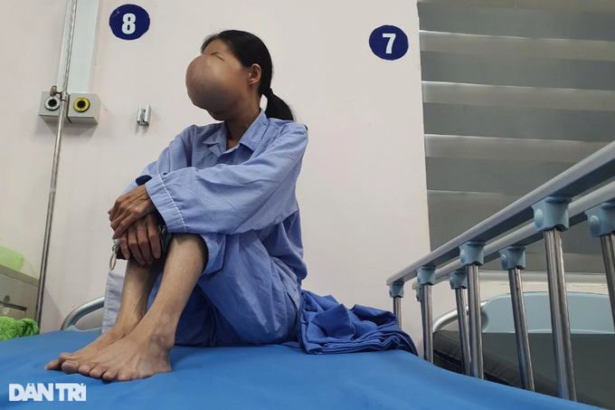 Người mẹ mang gương mặt kỳ dị hy sinh sự sống cho con - 3 Người mẹ mang gương mặt kỳ dị hy sinh sự sống cho con - 3