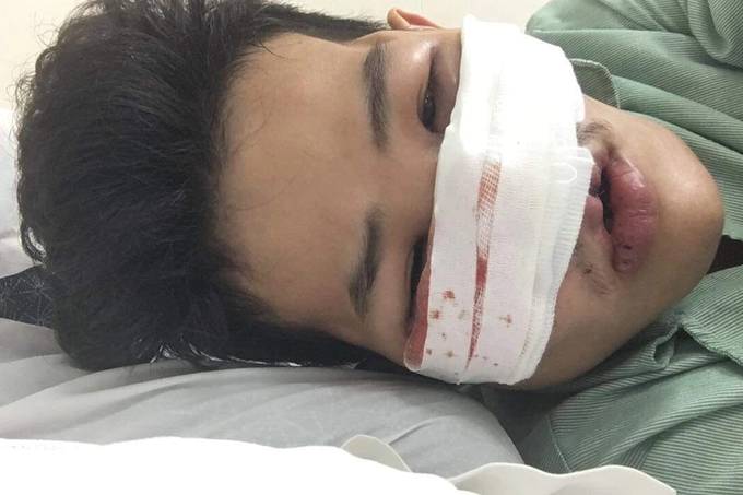 Người mẹ mang gương mặt kỳ dị hy sinh sự sống cho con - 4 Người mẹ mang gương mặt kỳ dị hy sinh sự sống cho con - 4