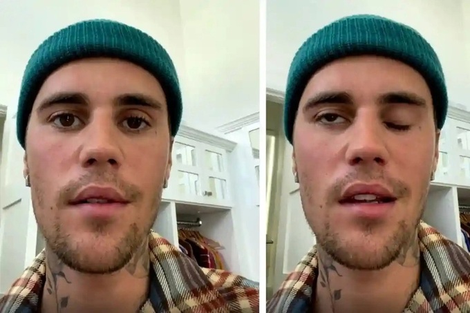 Liên tục bị đồn mang bầu, Hailey Bieber nói rõ: Tôi bị u nang buồng trứng - 3 Liên tục bị đồn mang bầu, Hailey Bieber nói rõ: Tôi bị u nang buồng trứng - 3
