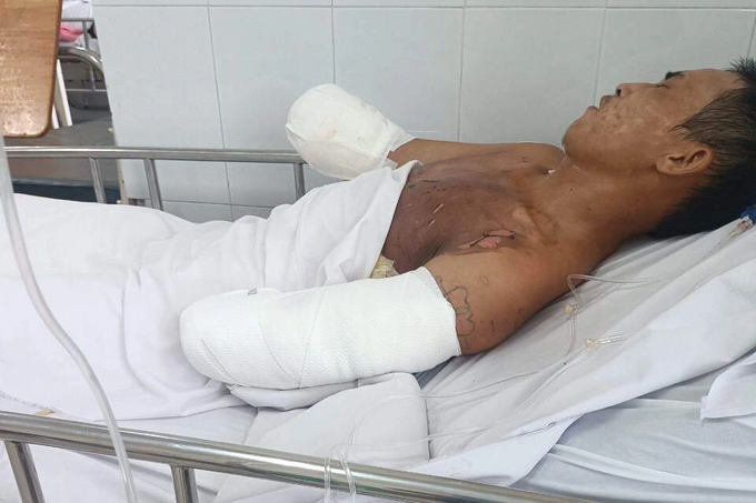 Anh thợ hồ mất hai tay, bán vé số nuôi 6 miệng ăn ráng mơ một đám cưới - 4 Anh thợ hồ mất hai tay, bán vé số nuôi 6 miệng ăn ráng mơ một đám cưới - 4