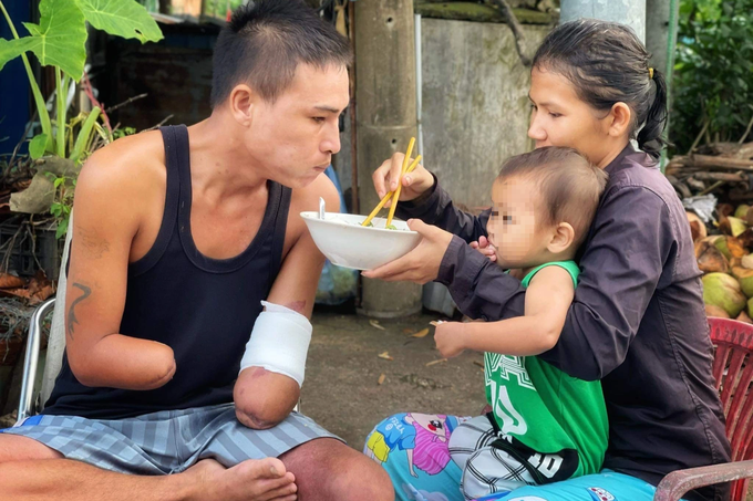 Anh thợ hồ mất hai tay, bán vé số nuôi 6 miệng ăn ráng mơ một đám cưới - 3 Anh thợ hồ mất hai tay, bán vé số nuôi 6 miệng ăn ráng mơ một đám cưới - 3