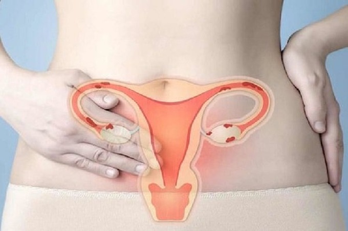Liệu mẹ bị ung thư cổ tử cung có tăng nguy cơ cho con mắc bệnh không?
