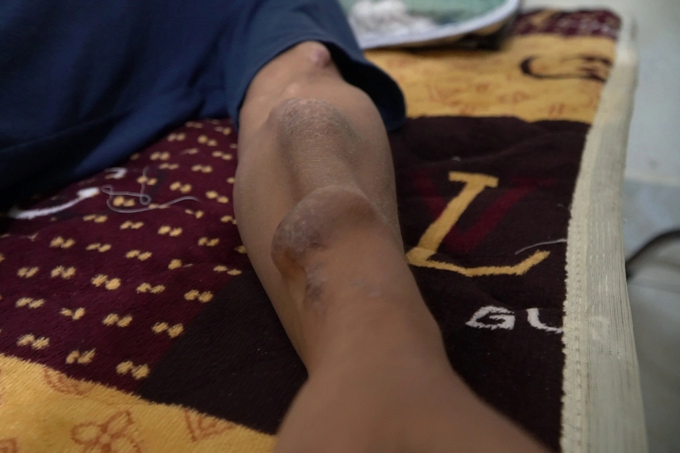 Nước mắt người vợ trẻ gần 10 năm xuyên Tết chăm chồng, con ở viện - 4
