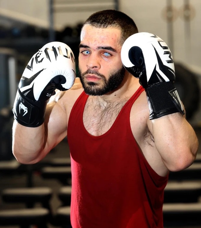 Chuyện lạ boxing: Võ sĩ mù cả hai mắt thách đấu đối thủ - 1 Chuyện lạ boxing: Võ sĩ mù cả hai mắt thách đấu đối thủ - 1