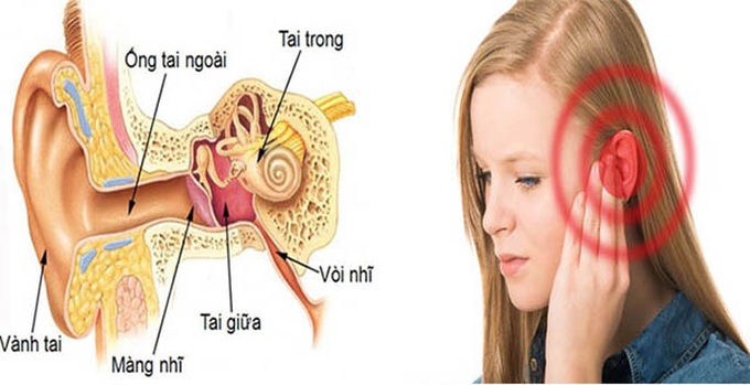 Các nguyên nhân gây đau tai và cách xử trí - 1