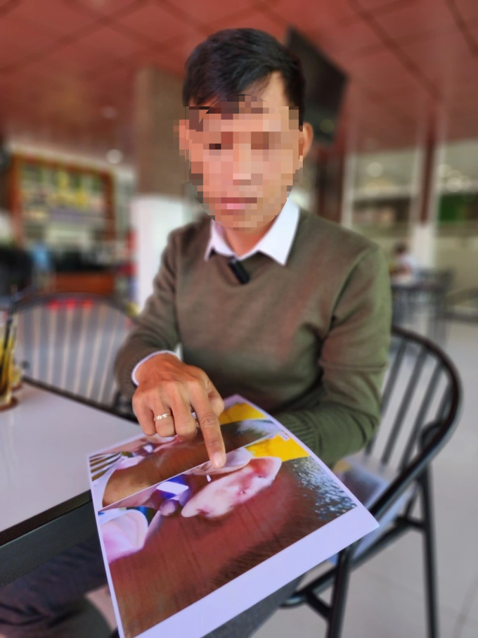 Bạo hành trẻ, một cô giáo mầm non ở Kiên Giang bị khởi tố - 1
