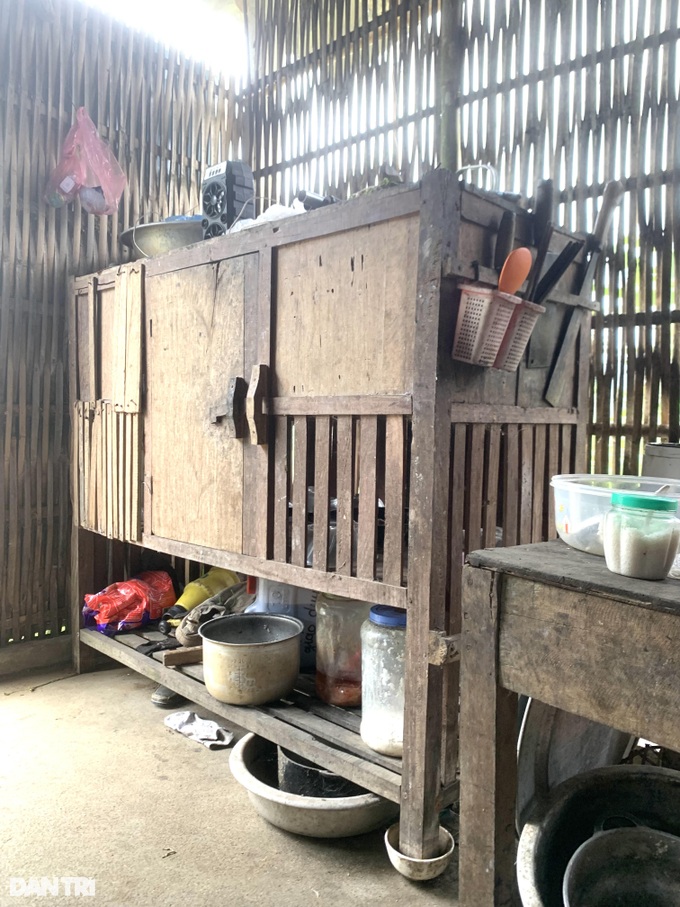 Cậu bé biến dạng khuôn mặt vì ngã vào nước nóng, gần 4 tuổi chưa biết nói - 4 Cậu bé biến dạng khuôn mặt vì ngã vào nước nóng, gần 4 tuổi chưa biết nói - 4