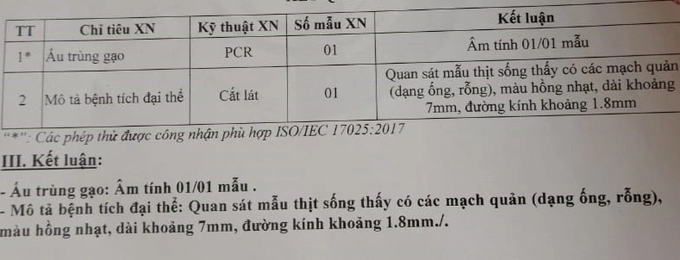 GoGi House bị khách tố có sán trong thịt: Nhà hàng tung kết quả kiểm nghiệm - 2