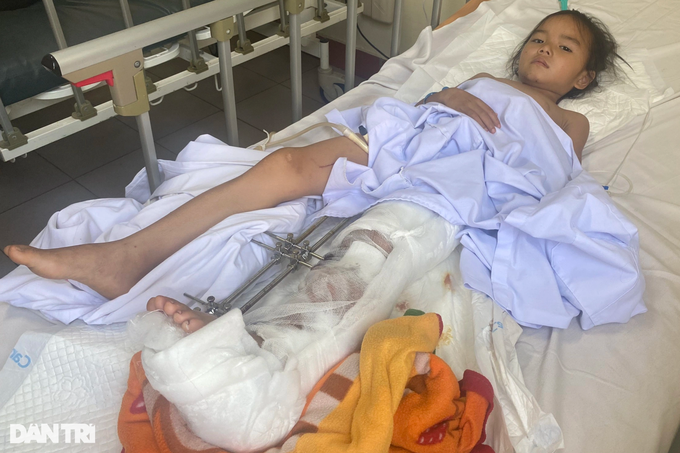 Chị em bé gái bị tai nạn: Xin hãy cứu cháu với! - 1