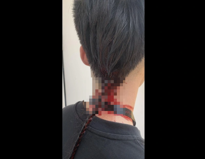 Hà Nội: Sinh viên hành hung bạn đổ máu tại trường học - 2