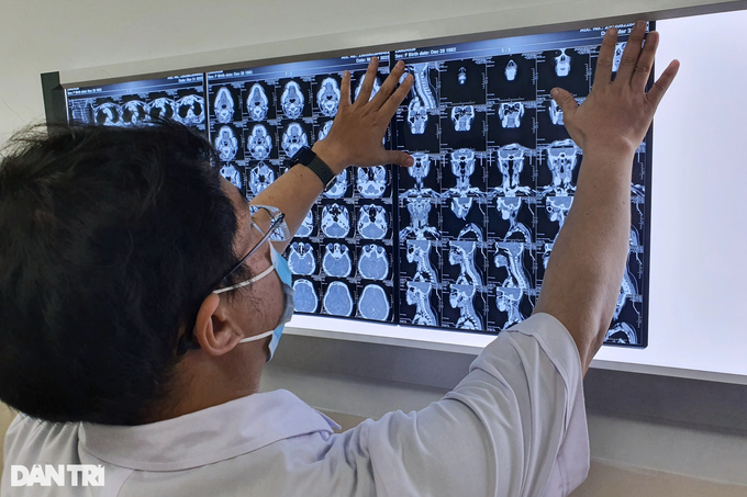 Ngộ nhận khi tầm soát loại ung thư làm 20.700 người Việt chết mỗi năm - 2