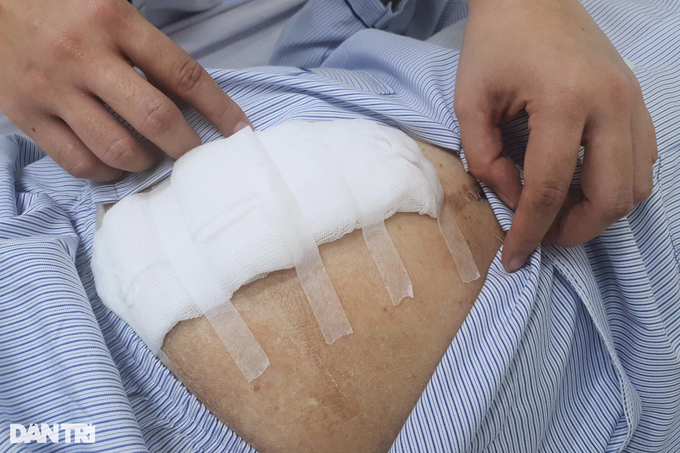 Căn bệnh hiểm ở ruột gây nhiễm độc, có thể mất mạng chỉ trong 3 ngày - 2